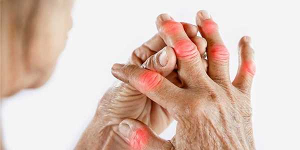 What Are The First Signs Of Arthritis In Fingers